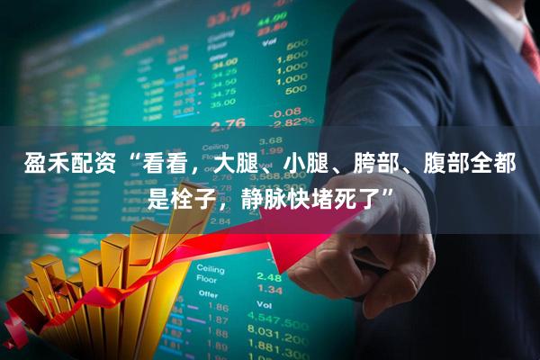 盈禾配资 “看看，大腿、小腿、胯部、腹部全都是栓子，静脉快堵死了”